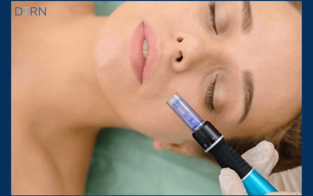 Skin Microneedling Options – Skin Pen and More!
