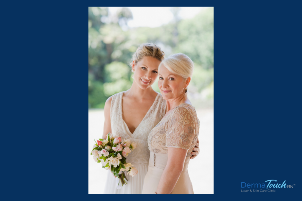 Treatments to Get Mother of the Bride Ready in Four Months or Less at Houston DermaTouch RN - pre wedding skin care