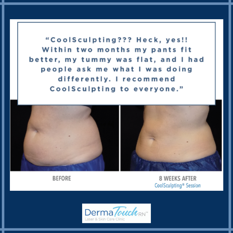 Houston CoolSculpting Results Before & After