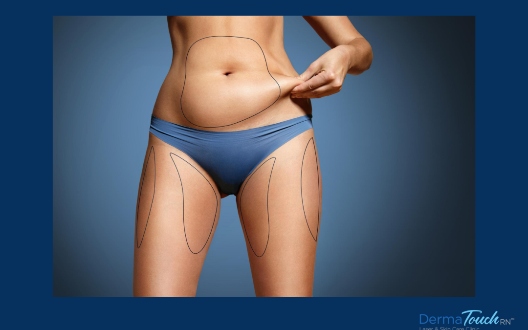 CoolSculpting Eliminates Treated Fat Cells