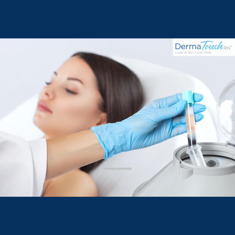 What is a PRP Treatment at DermaTouch RN?