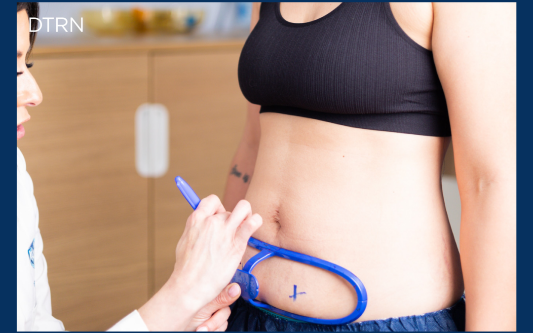 Who Is a Good Candidate for CoolSculpting Elite?