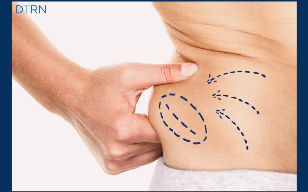 What Is Cryolipolysis?