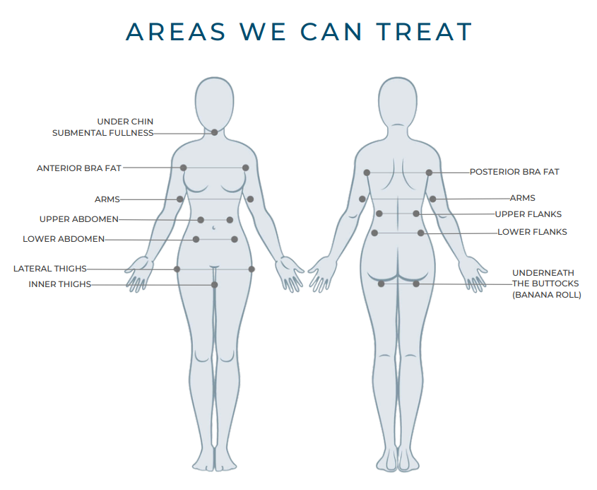 CoolSculpting® in Houston, TX