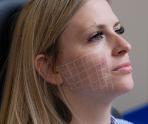 Skinvive by Juvederm DermaTouch RN blog
