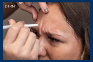 Botox Injections image