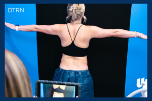 Is CoolSculpting permanent fat removal?