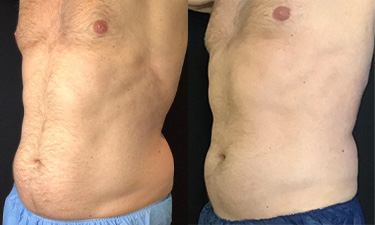 Body & Wellness Treatments Image