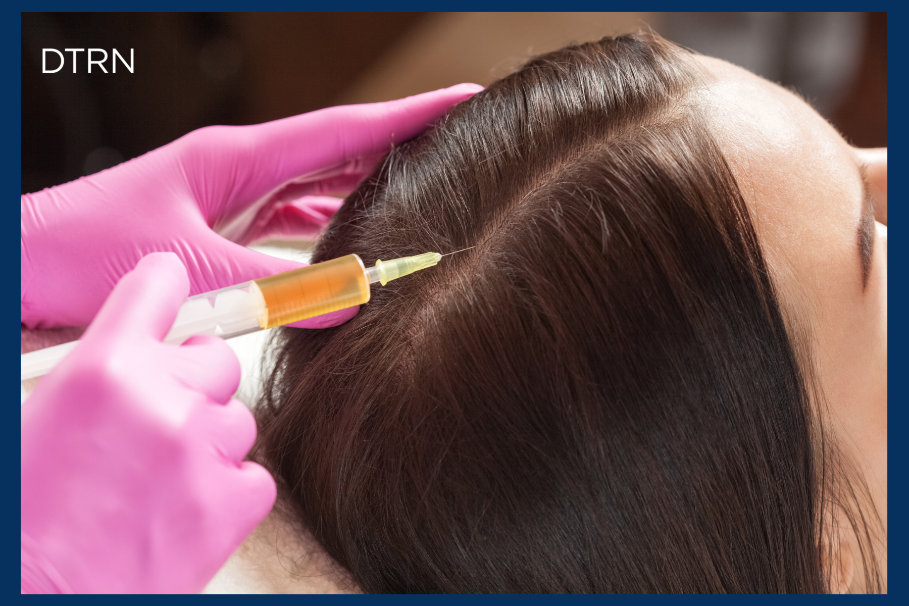 Hair Restoration Near Me DermaTouch RN Houston San Antonio
